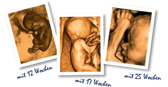 Die vorgeburtliche Entwicklung Die vorgeburtliche Entwicklung